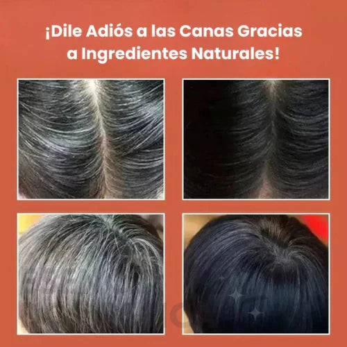🔥Di adiós a las canas y recupera tu look joven en casa – Con fórmula natural, tratamiento completo y 2 obsequios exclusivos de regalo 🎁